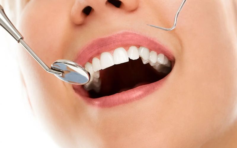Ağız ve diş sağlığı için dikkat edilmesi gerekenler Ağız ve diş sağlığı için - Antalya