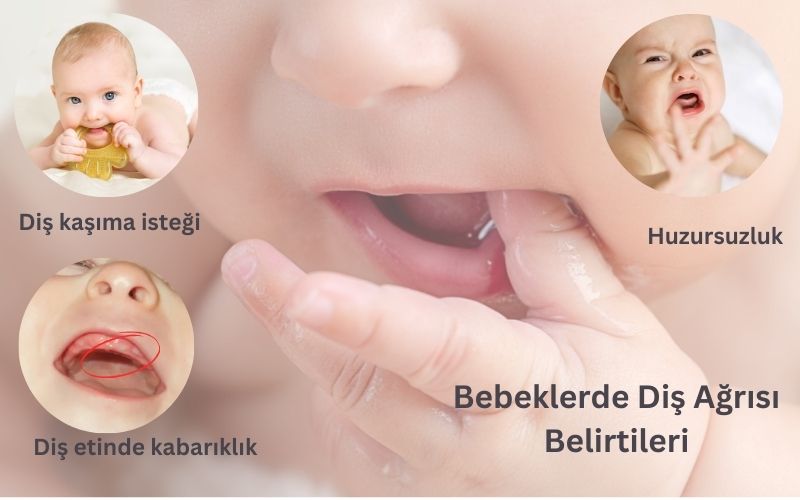 Bebeklerde diş çıkarma belirtisi Bebeklerde diş çıkarma belirtisi