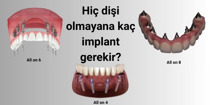 Hiç Dişi Olmayana Kaç İmplant Gerekir? Antalya