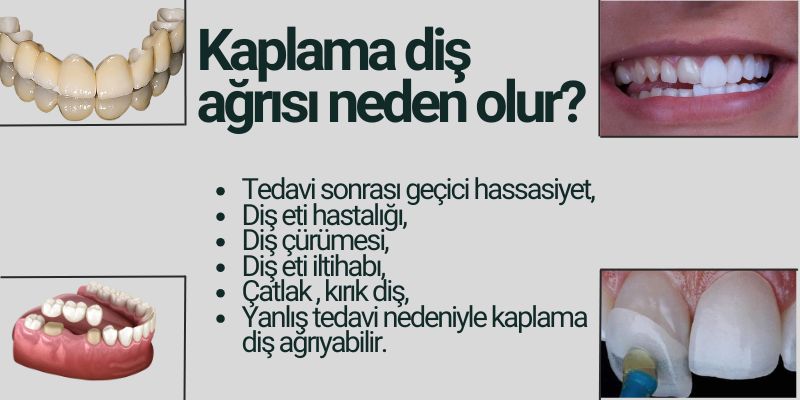 Kaplama Diş Ağrısı Neden Olur? Kaplama Diş Ağrısı Neden Olur? - Antalya