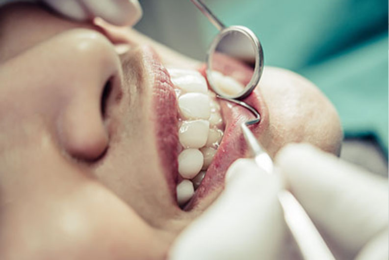 İmplant Diş Tedavisi diş implantı